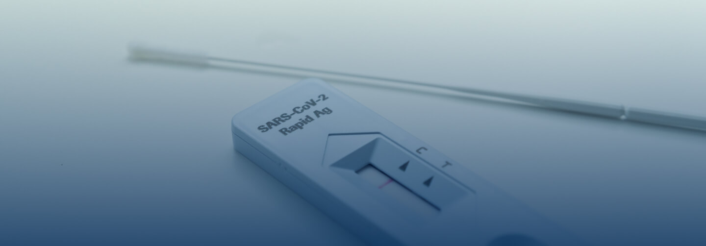 prueba Antigenos roche img