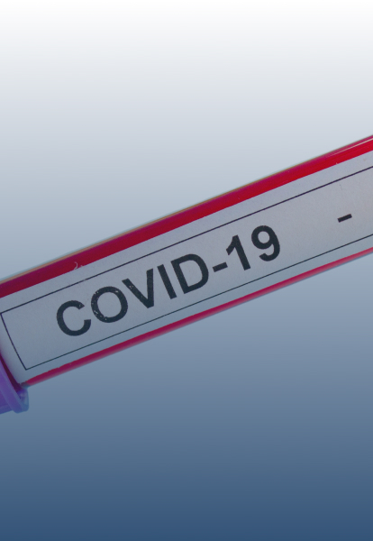 prueba Antigenos roche img