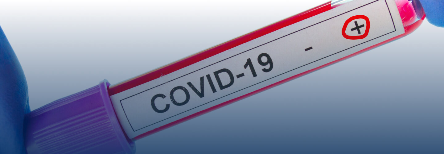 prueba Sangre IgG img