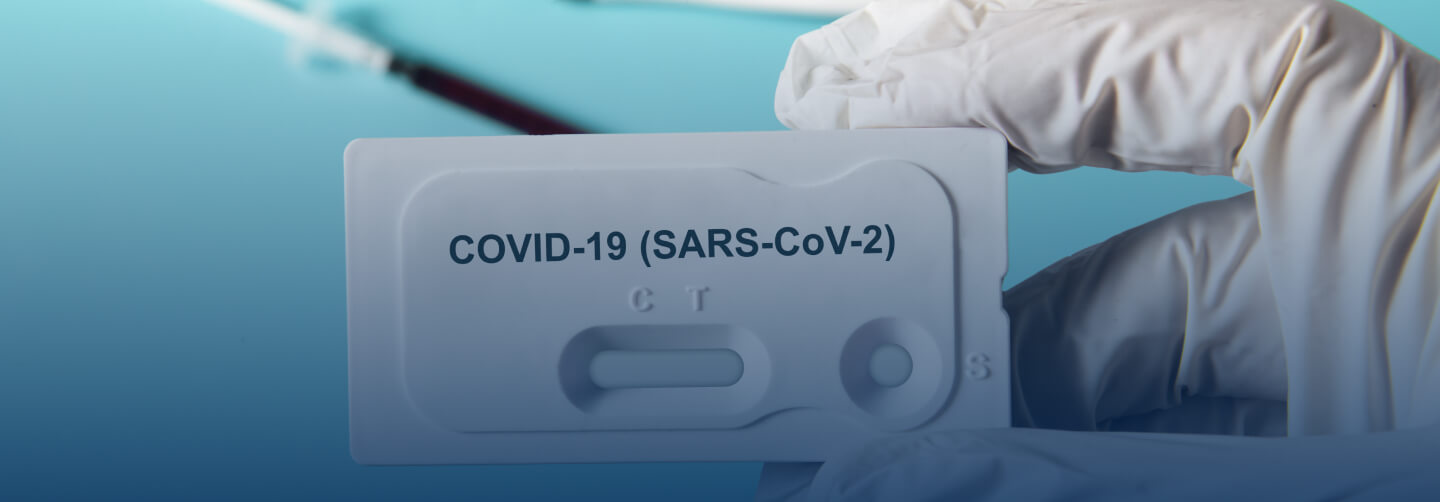 prueba Rapida de Anticuerpos roche img
